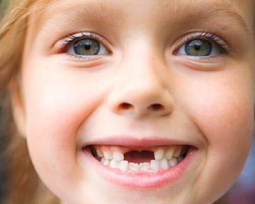 5 mẹo để con có hàm răng đều, không khấp khểnh, hô móm