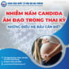 Nhiễm nấm Candida âm đạo trong thai kỳ, những điều mẹ bầu cần biết !