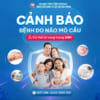 Bệnh do Não mô cầu – Có thể tử vong trong 24H