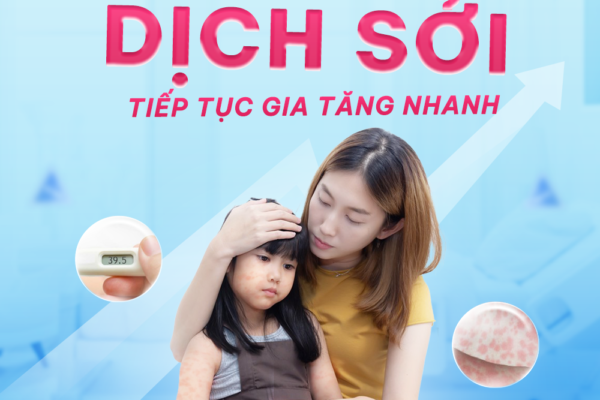 Dịch bệnh Sởi tiếp tục gia tăng nhanh: Phụ huynh cần hết sức cảnh giác!