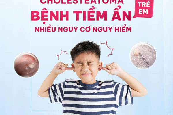 CHOLESTEATOMA Ở TRẺ EM: BỆNH TIỀM ẨN NHIỀU NGUY CƠ NGUY HIỂM