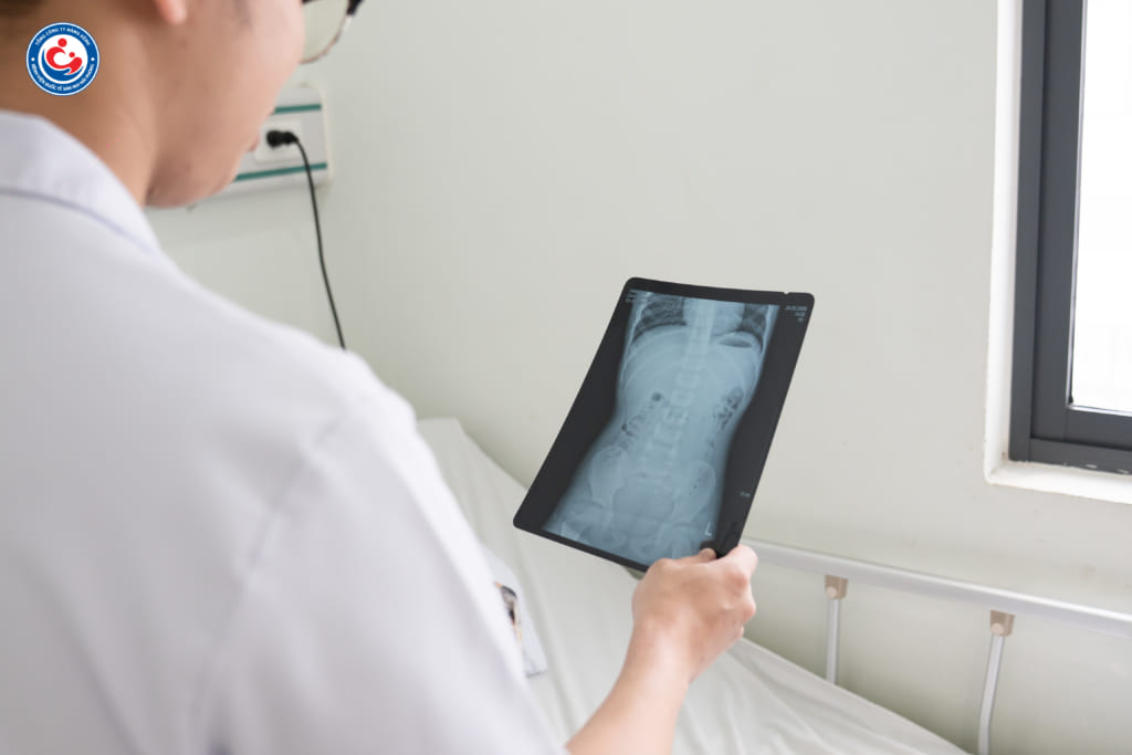 Hình ảnh X quang thận của bệnh nhi